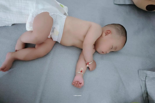 永兴六个月宝宝眼睛散光
